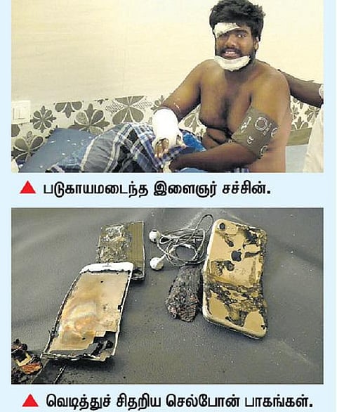 செல்போன் வெடித்து இளைஞர் காயம்