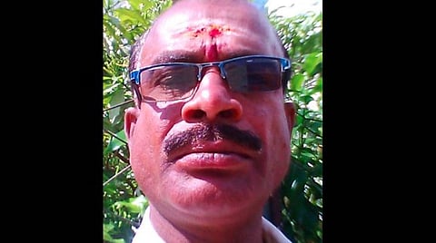வாக்கு எண்ணிக்கையில் வித்தியாசம்: மறுதேர்தல் நடத்த ஆணையத்திடம் ஆண்டிபட்டி ஏத்தாகோயில் வேட்பாளர் புகார்