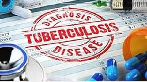 குமரியில் வெளியூர் காசநோயாளிகள் இருந்தால் சிகிச்சையை தொடர சிறப்பு ஏற்பாடு: காசநோய் ஒழிப்பு திட்ட இயக்குனர் தகவல்