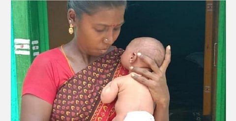 'இந்து தமிழ்' இணையதளச் செய்தி எதிரொலி: சிவகங்கை ஆட்சியர் உதவியால் பச்சிளங் குழந்தையின் முதுகில் இருந்த கட்டி அகற்றம்