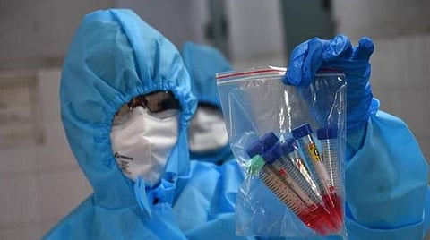 கரோனா தொற்று பரிசோதனையில் சென்னை மாநகராட்சி தொடர்ந்து முதலிடம்- இதுவரை 12 ஆயிரம் பேருக்கு பரிசோதனை
