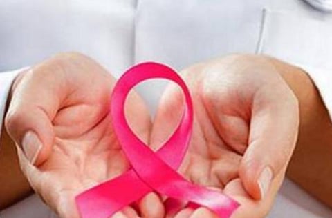 பிரதிநிதித்துவப் படம்