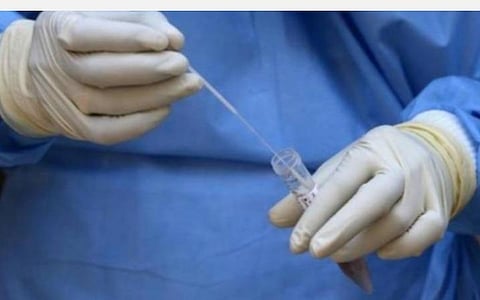 இந்தியாவில் மொத்தம் 1.82 கோடி கரோனா பரிசோதனைகள்: மத்திய சுகாதார அமைச்சகம் தகவல்