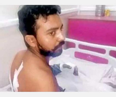 உ.பி.யின் தாத்ரியில் அடித்து கொல்லப்பட்ட அக்லாக் வழக்கின் குற்றவாளி மீது துப்பாக்கி சூடு