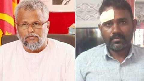 இலங்கை அமைச்சர் டக்ளஸ் தேவானந்தா (இடது) ; தாக்கப்பட்ட மீனவர் சுரேஷ் (வலது)