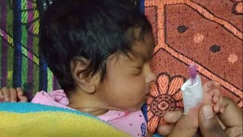 அரசு மருத்துவமனையில் 14 நாள் குழந்தையின் கட்டை விரல் துண்டிப்பு: இடைக்கால நிவாரணமாக ரூ.75 ஆயிரம் வழங்க நீதிமன்றம் உத்தரவு- கட்டை விரலைப் பொருத்தவும் ஆணை