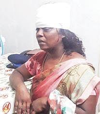 விருத்தாசலம் அரசு மருத்துவ மனையில் தலையில் வெட்டுக் காயங்களுடன் சிகிச்சைப் பெறும் நதியா.