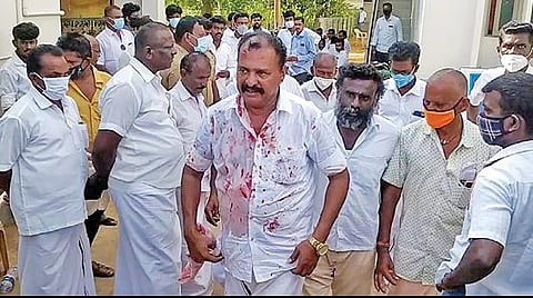 சிவகங்கை குடிநீர் வடிகால் வாரிய அலுவலகத்தில் ஒப்பந்தம் எடுப்பதில் திமுகவினர் இடையே ஏற்பட்ட மோதலில் காயமடைந்த நிர்வாகி சோமன்.
