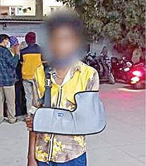 தாக்குதலில் கை முறிந்த நிலையில் மாணவர்.