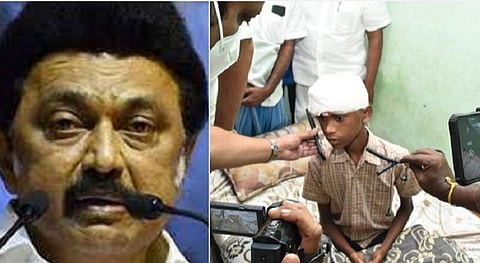 நாமக்கல் மாவட்டத்தில் சாலை விபத்தில் மூளையில் அடிபட்டுஉயிர்பிழைத்த சிறுவனிடம் போனில் முதல்வர் மு.க. ஸ்டாலின் உடல்நலம் விசாரித்தார்.
