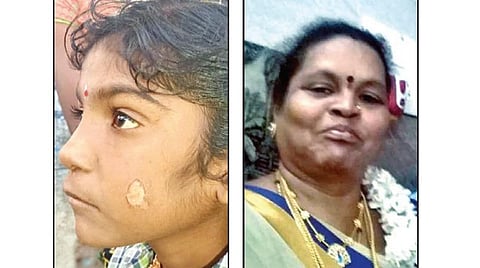 தீக்காயத்துடன் மாணவி கவுதமி. அடுத்த படம்: தலைமை ஆசிரியை உஷா ராணி.