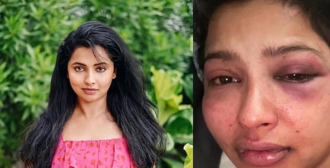 “முன்னாள் காதலரால் தாக்கப்பட்டேன்” - மலையாள நடிகை அனிகா விக்ரமன்
