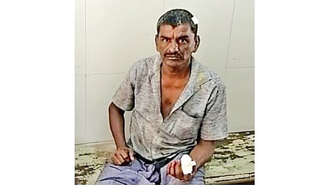 விரல் துண்டாகி மருத்துவமனையில் அனுமதிக்கப்ப்டட கதிரேசன்.