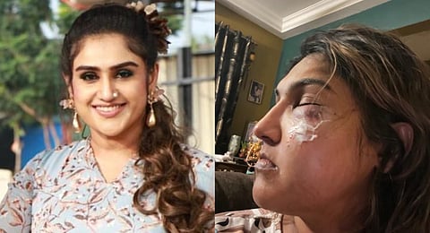 நடிகை வனிதா மீது மர்ம நபர் தாக்குதல் - ’பிக்பாஸ்’ பிரதீப் ஆதரவாளர் என்று குற்றச்சாட்டு