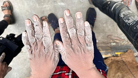 மத்திய பிரதேச மதுபான ஆலையில் காயங்களுடன் பணியாற்றிய 58 குழந்தை தொழிலாளர்கள் மீட்பு