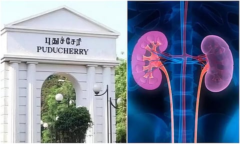 புதுச்சேரி ஹோமியோபதி மருத்துவமனையில் சிறுநீரகக் கல் கரைக்கும் சிகிச்சை விரைவில் தொடக்கம்