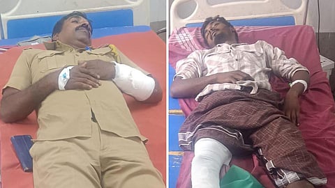 காயமடைந்த உதவி ஆய்வாளர் கோட்டியப்பசாமி மற்றும் கைதான நாகராஜ் மருத்துவமனையில் சிகிச்சை பெற்று வருகின்றனர்.