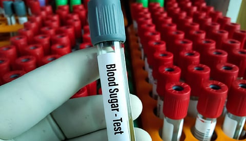 15,000+ சிறிய ரத்தப் பரிசோதனை நிலையங்ளை மூடும் நிலை: அரசாணைக்கு இந்திய கம்யூ. எதிர்ப்பு