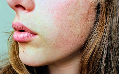 Lip Plumping: Three natural ways for fuller lips