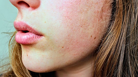 Is your skin dry or dehydrated?
