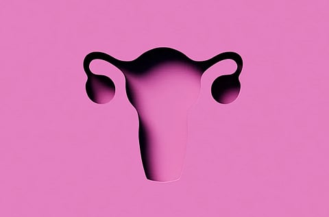 Experts say that polyendocrine metabolic ovarian syndrome (PMOS), and re-categorising of the name PCOS, will describe the condition best