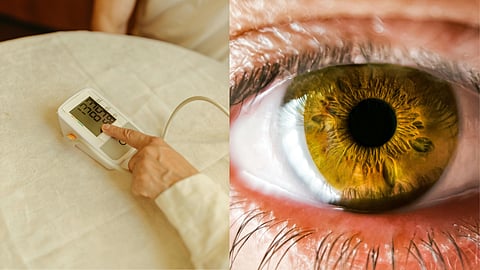 World Hypertension Day 2026: How does untreated hypertension lead to hypertensive retinopathy of the eyes?
