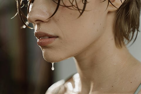 Hyperhidrosis: Do you sweat extensively even if it’s not hot?