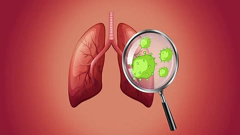 lungs cancer