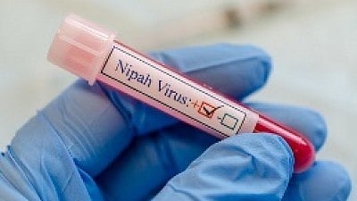 Two nurses in critical condition after testing positive for Nipah virus in West Bengal