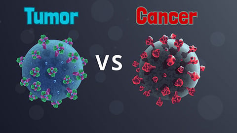 Differences between Tumor and Cancer