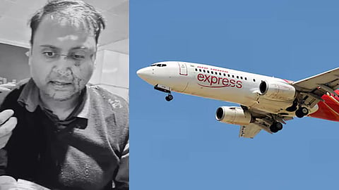 The passenger, Ankit Dewan, posted on X a photo with blood on his face