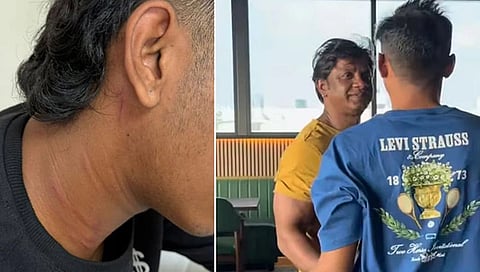 Complaint filed against Actor Duniya Vijay's son for assaulting college batchmate in Bengaluru