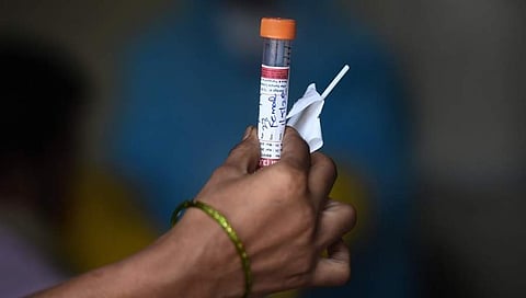 ಸಾಂದರ್ಭಿಕ ಚಿತ್ರ