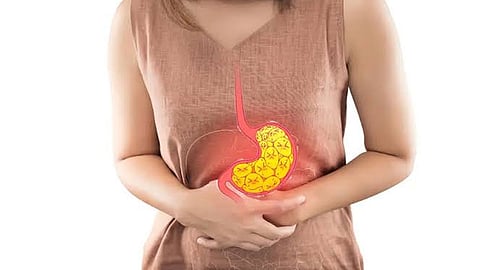 stomach ulcers
