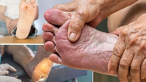 Diabetics