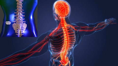 Spinal cord stimulation