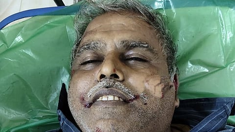 ஈரோடு கலெக்டர் கார் மோதிய விபத்தில் விவசாயி பலி