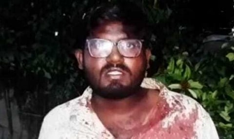 வழிப்பறி கும்பலால் தாக்கப்பட்ட பூபாலகிருஷ்ணன்.