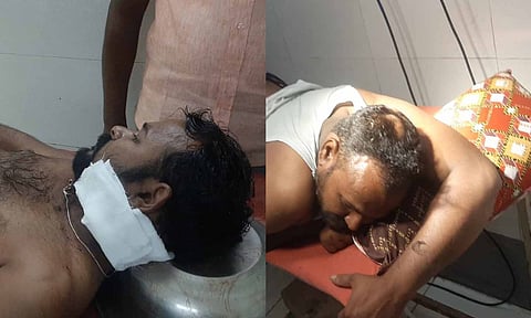 காயமடைந்தவர்கள் ஆஸ்பத்திரியில் சிகிச்சை பெற்று வரும் காட்சி. 