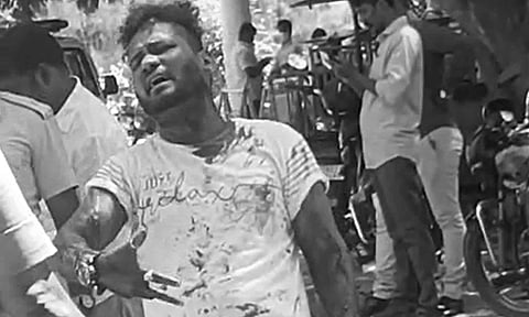 சென்னை கமிஷனர் அலுவலகத்தில் பிளேடால் உடலை வெட்டிய வாலிபர்