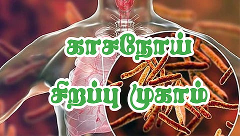 நாடமாடும் எக்ஸ்ரே வாகனம் மூலம் காசநோய் கண்டறியும் சிறப்பு முகாம்