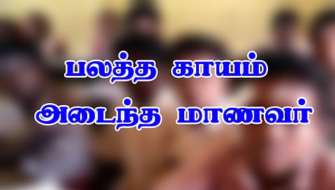 இளம்பிள்ளை அருகே அரசு பள்ளி மாடியில் இருந்து விழுந்த 9-ம் வகுப்பு மாணவருக்கு தொடர் சிகிச்சை
