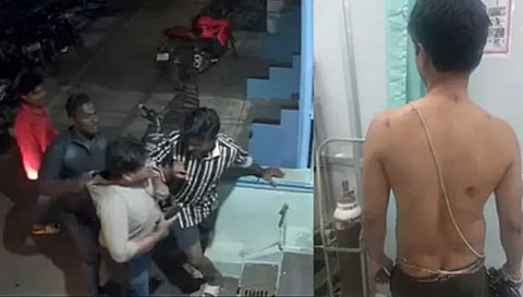 வாலிபரை தாக்கிய கும்பல். காயமடைந்த வாலிபர்.