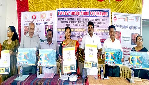 தொழுநோய் விழிப்புணர்வு போஸ்டரை நாமக்கல் மாவட்ட தொழுநோய் பிரிவு இணை இயக்குனர் மருத்துவர் ஜெயந்தினி வெளியிட்ட காட்சி. அருகில் கபிலக்குறிச்சி ஊராட்சி மன்றத்தலைவர் வடிவேலு, வேர்டு செயலாளர் சிவகாமல்லி ஆகியோர் உள்ளனர்.