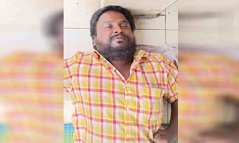  இறந்த நிலையில் கிடந்துள்ள ஆண் சடலத்தை படத்தில் காணலாம்.