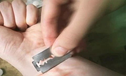 வாலிபர் தற்கொலை முயற்சி