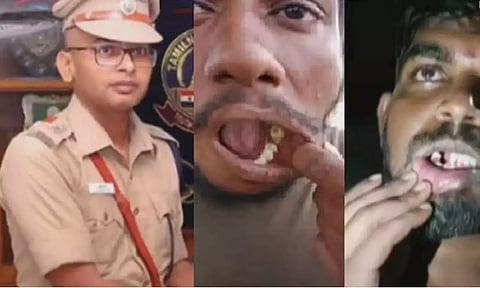 பல் பிடுங்கிய விவகாரம்: போலீஸ் அதிகாரி பல்வீர்சிங் உள்பட 14 பேர் கோர்ட்டில் ஆஜர்