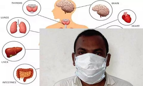 உடல் உறுப்பு வர்த்தக மோசடி கும்பலின் தலைவன் கைது