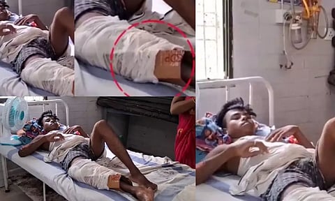 விபத்தில் காயமடைந்தவருக்கு அட்டைப் பெட்டியில் கட்டுப் போட்ட அரசு மருத்துவமனை - வைரல் வீடியோ