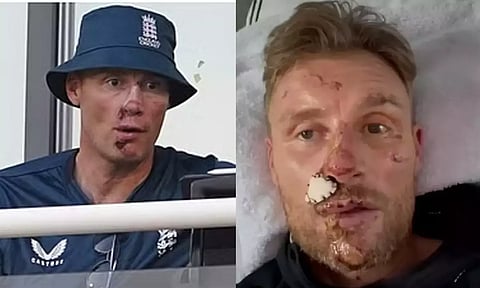 Andrew Flintoff